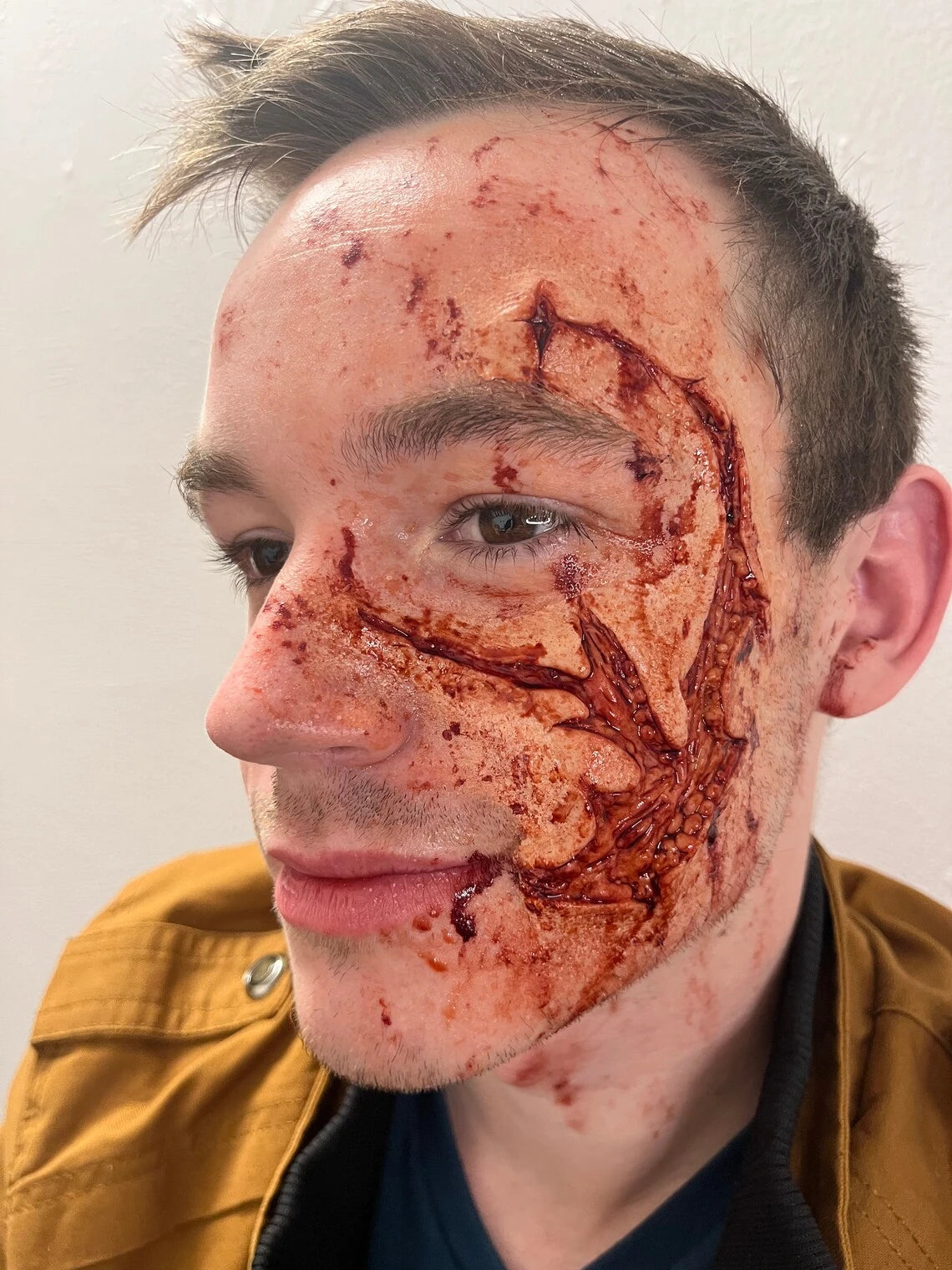 Face Trauma Prosthetic