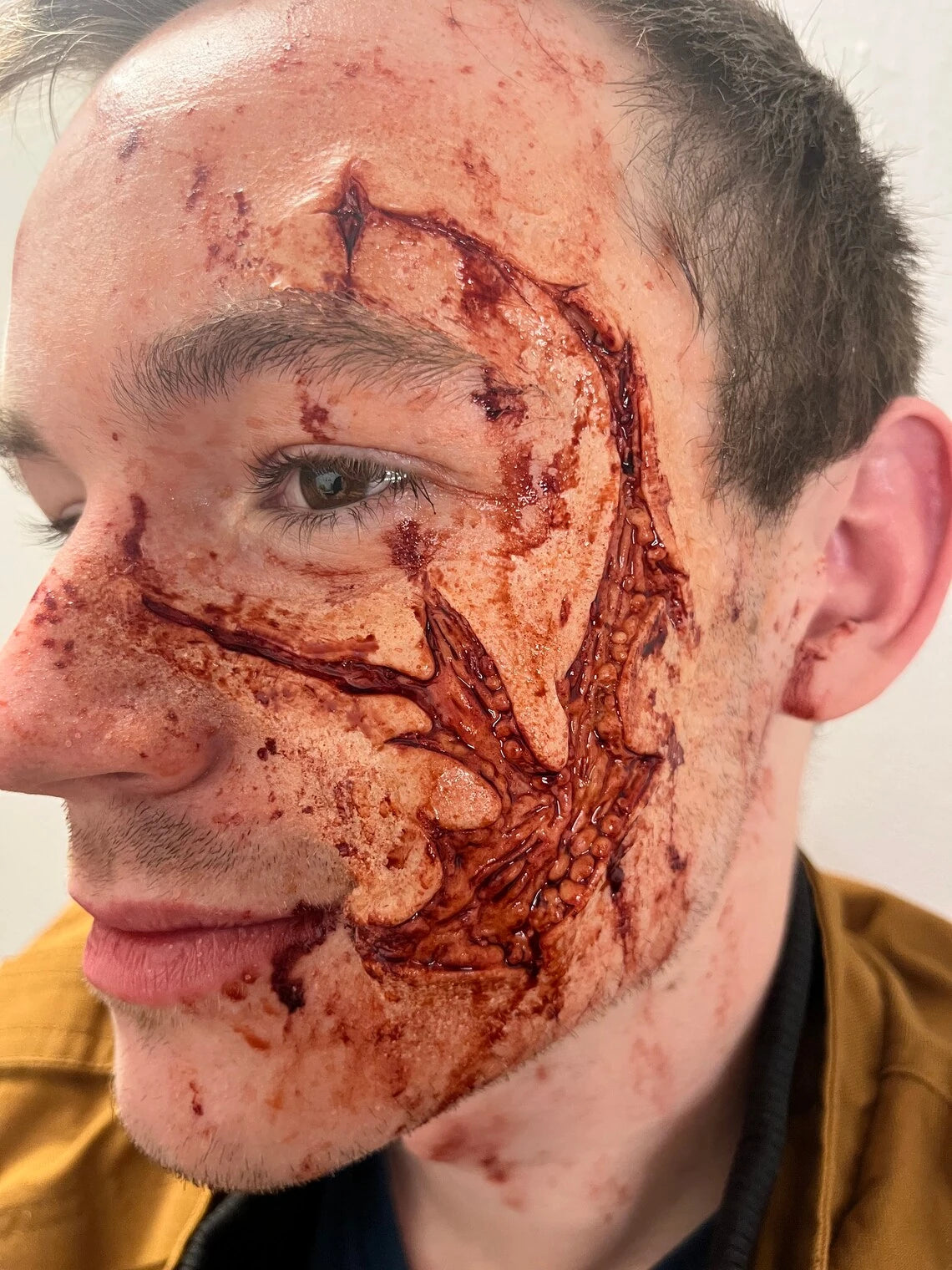 Face Trauma Prosthetic