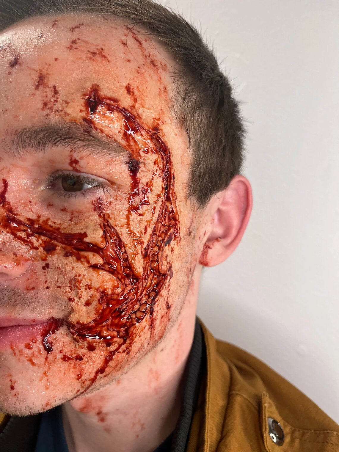 Face Trauma Prosthetic