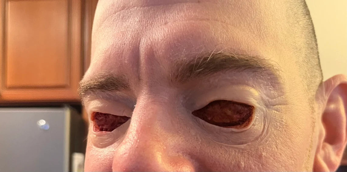 Gouged Eyes