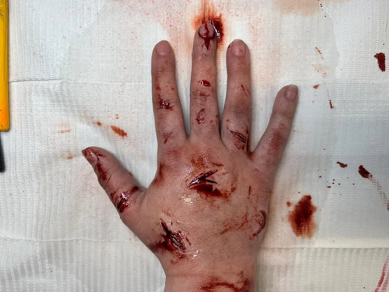 Small Laceration Set